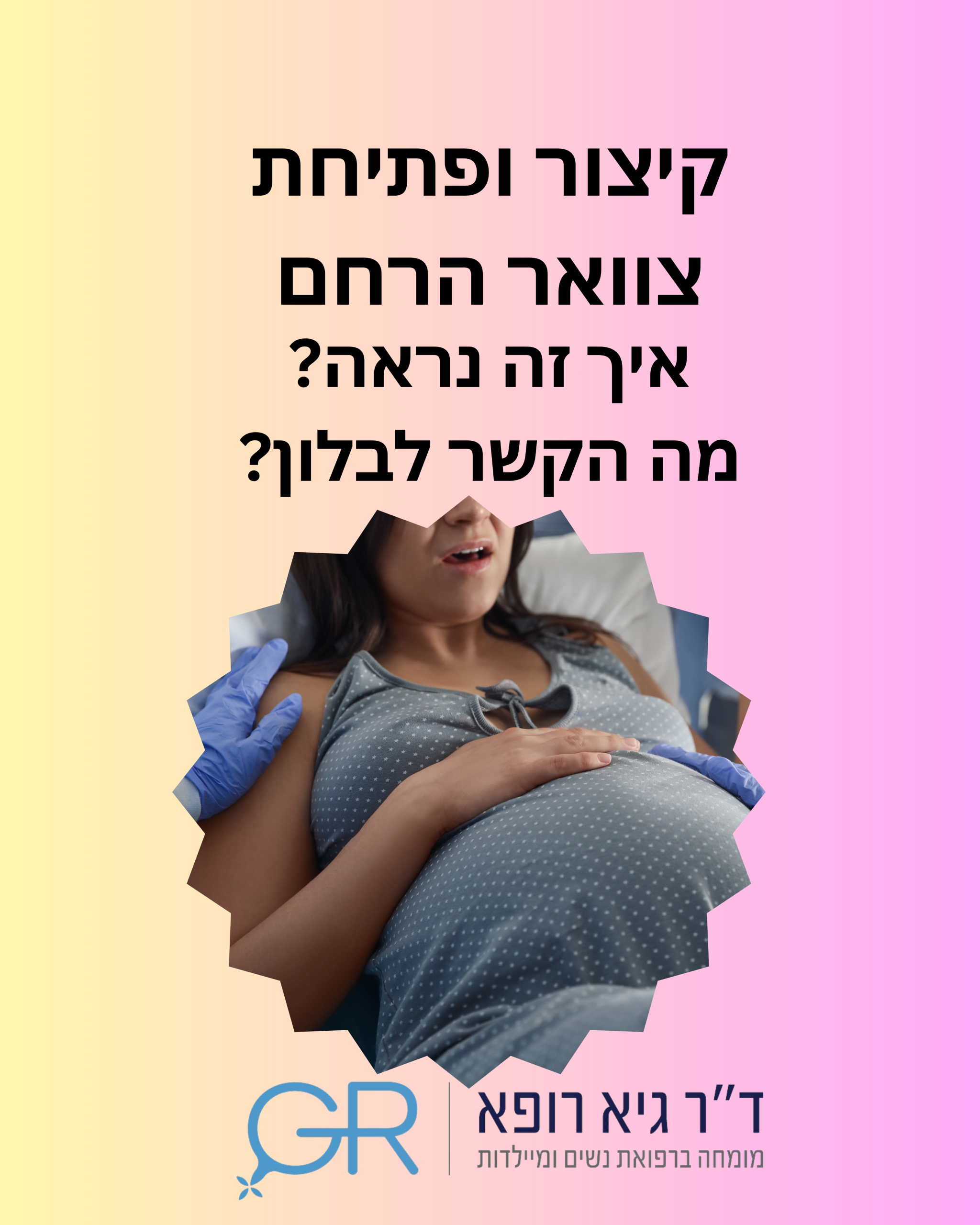 קיצור ופתיחת צוואר הרחם בלידה